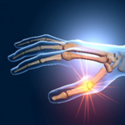 Extraordinary Service